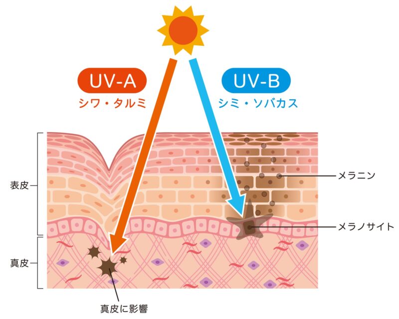 紫外線ダメージ
